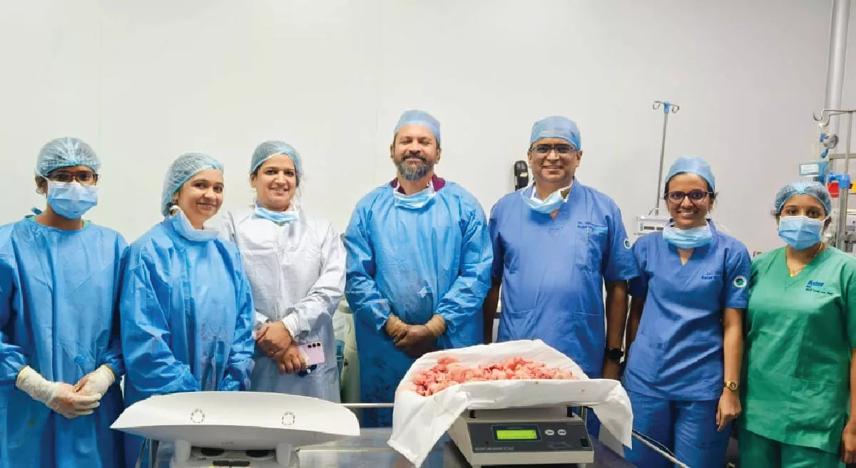one-of-the-largest-fibroid-uterus-removed-through-laparoscopic-surgery